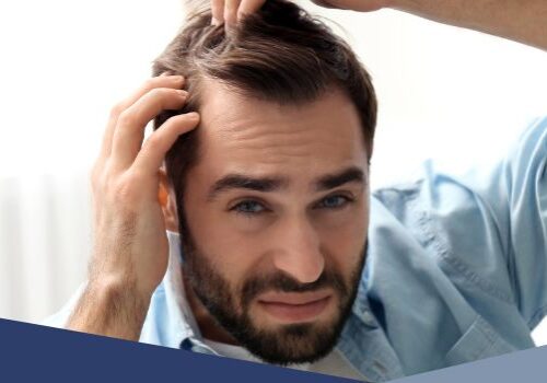finasteride vs minoxidil finasteride vs minoxidil